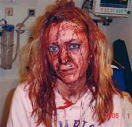 rape victim in Sweden